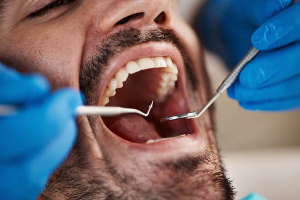 Best Walk-In Emergency Dentist in Roscoe, TX