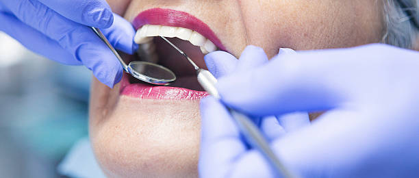 Best Emergency Wisdom Teeth Removal in Roscoe, TX